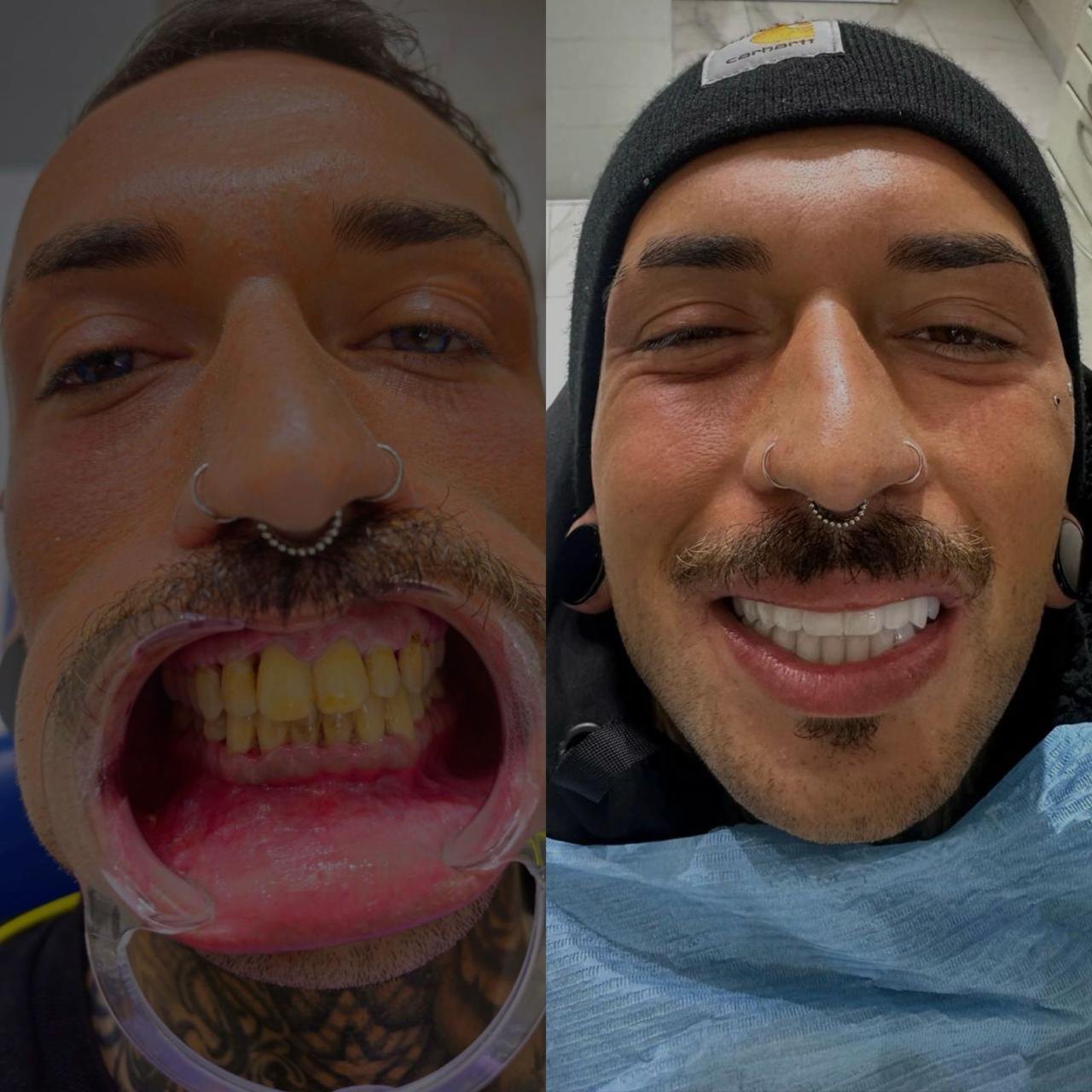 Prima e dopo caso 3