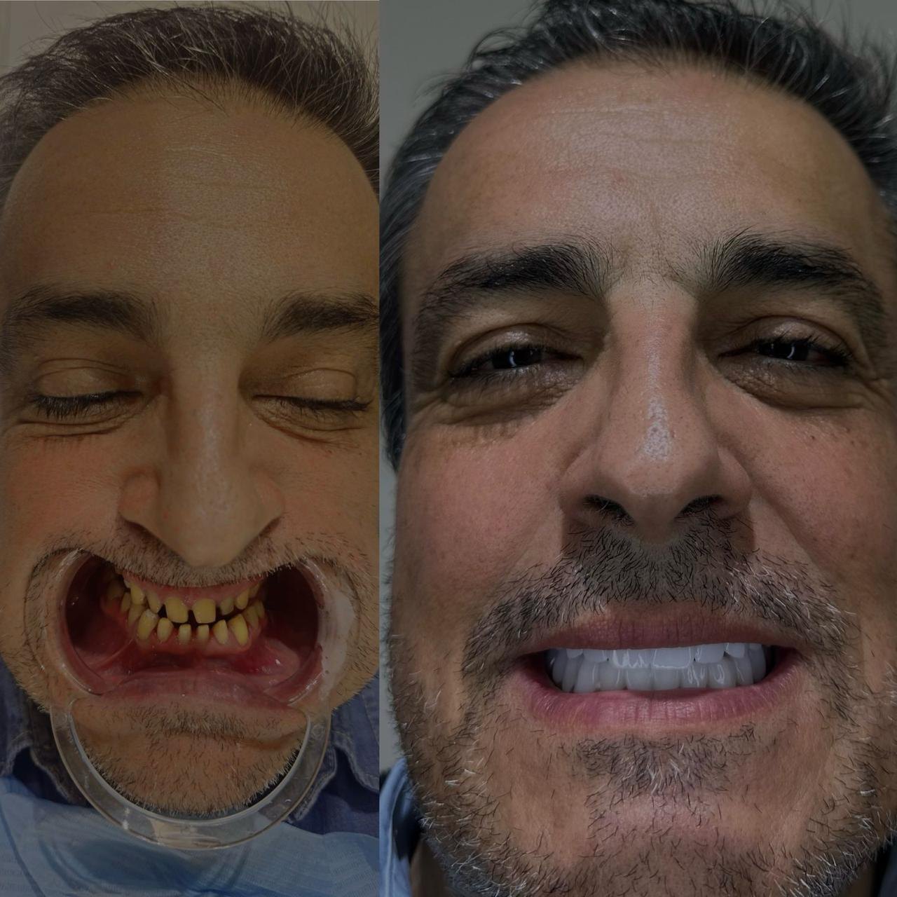 Prima e dopo caso 7